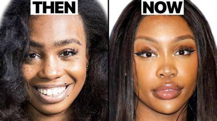 Did SZA Get Plastic Surgery? Transformation Photos, Quotes Life & Style