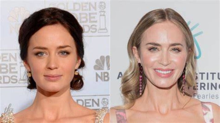 Emily Blunt has had fillers, said Dr Motykie, to make her face have a more female heart shape. She is pictured above in 2020