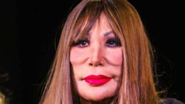 Lyn May habla tras ca&iacute;da y dice que el bailar&iacute;n le tuvo &ldquo;envidia&rdquo; UnoTV