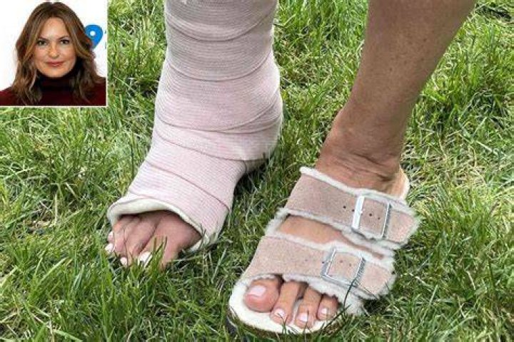 mariska hargitay ankle