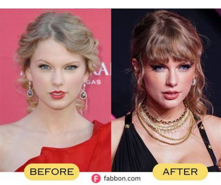 taylor swift plastic surgery 
