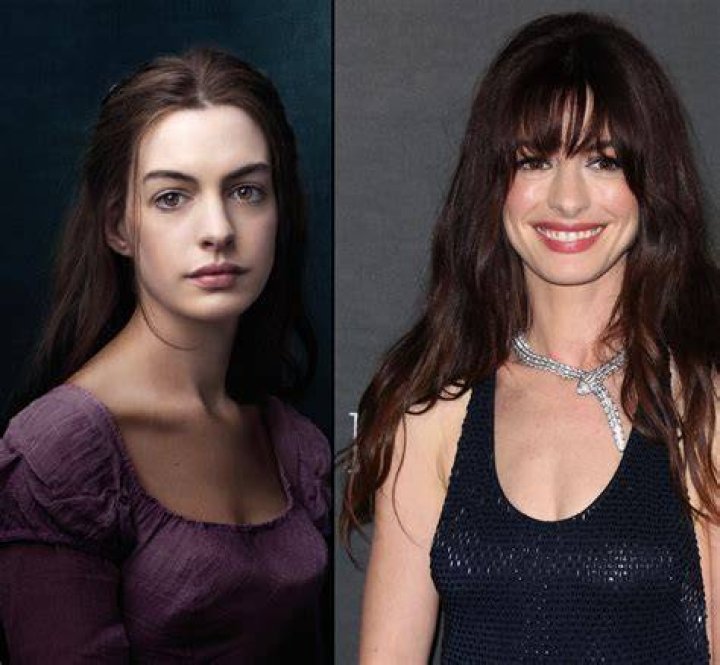 The 40-year-old Les Miserables actress appears to have had surgery on her nose, said Dr Motykie