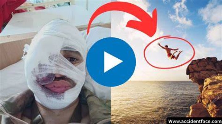 WATCH Face Split Diving Accident Incident Of 2009 Original Video Resurfaces On Twitter, Reddit